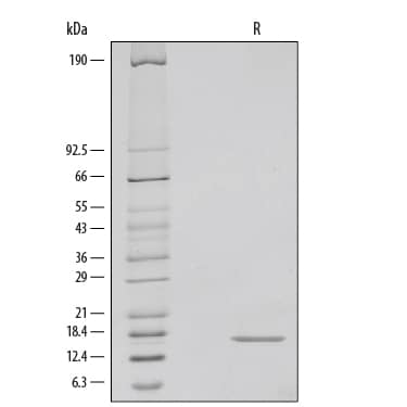 1 μg/lane of Recombinant Human IFN-gamma  was resolved with SDS-PAGE under reducing (R) conditions and visualized by silver staining, showing a single band at 17 kDa.