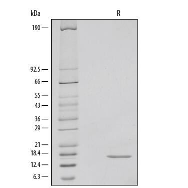 1 μg/lane of Recombinant Human IFN-gamma  was resolved with SDS-PAGE under reducing (R) conditions and visualized by silver staining, showing a single band at 17 kDa.