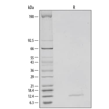 SDS-Page IFN-gamma [Unconjugated]