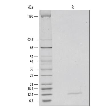 1 μg/lane of Recombinant Mouse IFN-gamma  was resolved with SDS-PAGE under reducing (R) conditions and visualized by silver staining, showing a single band at 11-12 kDa.