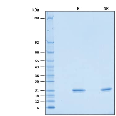 2 μg/lane of Recombinant Mouse IFN-alpha 2/IFNA2 (Catalog # 10149-IF) was resolved with SDS-PAGE under reducing (R) and non-reducing (NR) conditions and visualized by Coomassie® Blue staining, showing bands at 18-22 kDa.