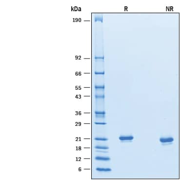 2 μg/lane of Recombinant Mouse IFN-alpha 6/IFNA6 was resolved with SDS-PAGE under reducing (R) and non-reducing (NR) conditions and visualized by Coomassie® Blue staining, showing bands at 19-22 kDa.