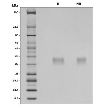 1 μg/lane of Recombinant Mouse IFN-beta (Catalog # 8234-MB/CF) was resolved with SDS-PAGE under reducing (R) and non-reducing (NR) conditions and visualized by silver staining, showing bands at 32.7 and 32.9 kDa, respectively.