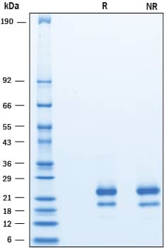 2 μg/lane of Recombinant Human IFN‑ gamma  (HEK293-expressed) was resolved with SDS-PAGE under reducing (R) and non-reducing (NR) conditions and visualized by Coomassie® Blue staining, showing bands at 19-25 kDa.