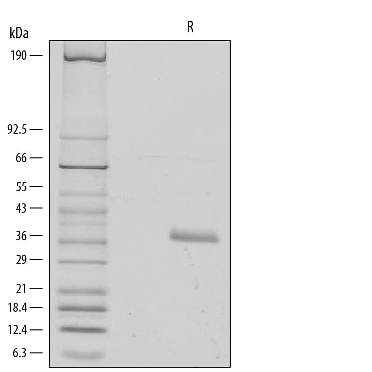 SDS-Page IGFBP-rp1/IGFBP-7 [Unconjugated]