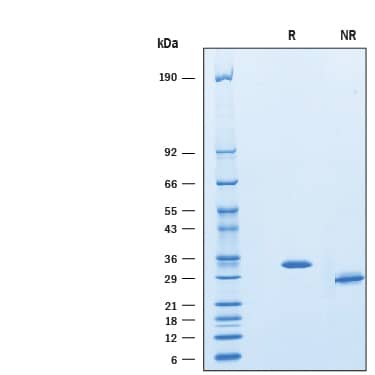SDS-Page IGFBP-rp1/IGFBP-7 [Unconjugated]
