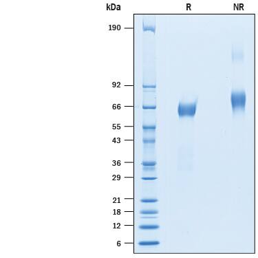 2 μg/lane of Recombinant Human IGSF21 His-tag (Catalog # 10330-S2) was resolved with SDS-PAGE under reducing (R) and non-reducing (NR) conditions and visualized by Coomassie® Blue staining, showing bands at 61-68 kDa.
