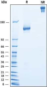 2 μg/lane of Recombinant Mouse IGSF2/CD101 was resolved with SDS-PAGE under reducing (R) and non-reducing (NR) conditions and visualized by Coomassie® Blue staining, showing bands at 121-150 kDa and 240-280 kDa, respectively.