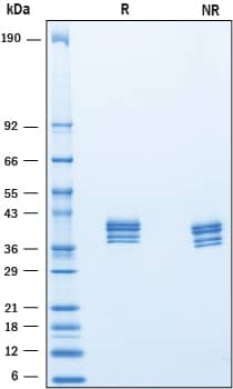 2 μg/lane of Recombinant Mouse IGSF4B/SynCAM3 was resolved with SDS-PAGE under reducing (R) and non-reducing (NR) conditions and visualized by Coomassie® Blue staining, showing bands at 35-44 kDa.