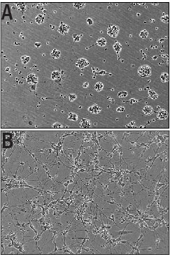 Recombinant Human IGSF4C/SynCAM4 Fc Chimera (Catalog # 9905-S4) Induces Cortical Neurite Outgrowth. A) Untreated E16-18 embryonic rat cortical neurons. B) Neurite outgrowth in E16-18 embryonic rat cortical neurons treated with 0.5 μg/mL of Recombinant Human IGSF4C/SynCAM4 Fc Chimera.