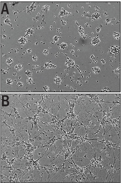 Recombinant Mouse IGSF4C/SynCAM4 Fc Chimera (Catalog # 9906-S4) Induces Cortical Neurite Outgrowth. A) Untreated E16-18 embryonic rat cortical neurons. B) Neurite outgrowth in E16-18 embryonic rat cortical neurons treated with 0.5 μg/mL of Recombinant Mouse IGSF4C/SynCAM4 Fc Chimera.