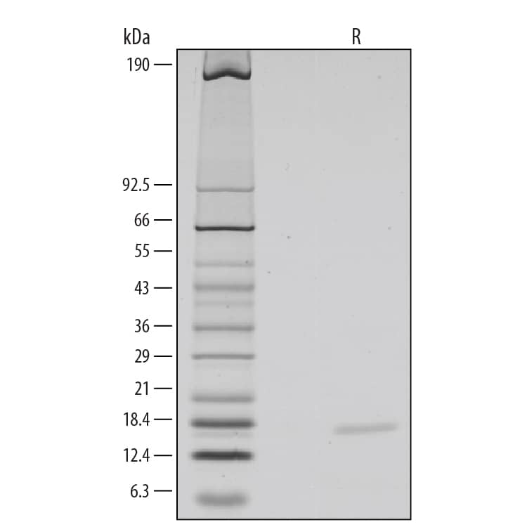 1 μg/lane of Recombinant Mouse IL-10 was resolved with SDS-PAGE under reducing (R) conditions and visualized by silver staining, showing a single band at 17 kDa.