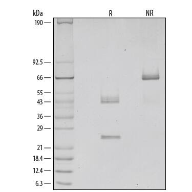 1 μg/lane of Recombinant Mouse IL-12 was resolved with SDS-PAGE under reducing (R) and non-reducing (NR) conditions and visualized by silver staining, showing single bands at 25 kDa and 43 kDa (R) and 68 kDa (NR) .