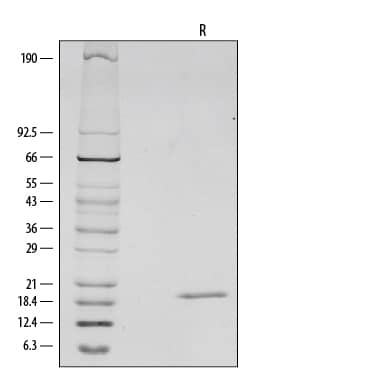 1 μg/lane of Recombinant Mouse IL1 beta /IL-1F2 was resolved with SDS-PAGE under reducing (R) conditions and visualized by silver staining, showing a single band at 19 kDa.