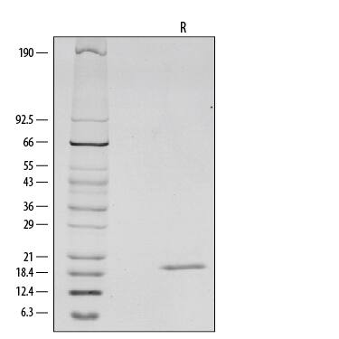1 μg/lane of Recombinant Mouse IL-1 beta /IL-1F2 was resolved with SDS-PAGE under reducing (R) conditions and visualized by silver staining, showing a single band at 19 kDa.