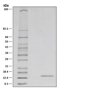 1 μg/lane of Recombinant Mouse IL-21 was resolved with SDS-PAGE under reducing (R) conditions and visualized by silver staining, showing a single band at 15 kDa.
