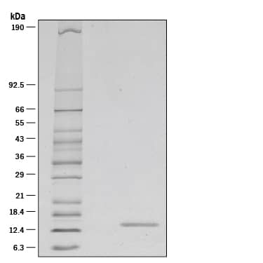 1 μg/lane of Recombinant Mouse IL-21 was resolved with SDS-PAGE under reducing (R) conditions and visualized by silver staining, showing a single band at 15 kDa.