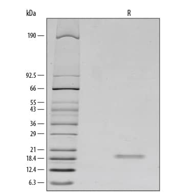 1 μg/lane of Recombinant Mouse IL-2 was resolved with SDS-PAGE under reducing (R) conditions and visualized by silver staining, showing a band(s) at 19 kDa.