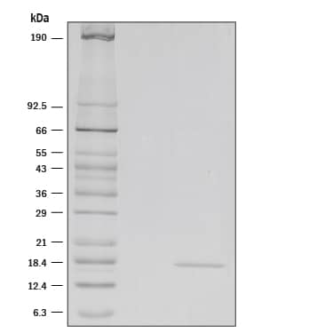 1 μg/lane of Recombinant Mouse IL-36 alpha /IL-1F6 (aa 8-160) was resolved with SDS-PAGE under reducing (R) conditions and visualized by silver staining, showing a single band at 17 kDa.