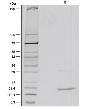 1 µg/lane of Recombinant Mouse IL-36 beta /IL-1F8 (aa 31-183) was resolved with SDS-PAGE under reducing (R) conditions and visualized by silver staining, showing a single band at 16 kDa.