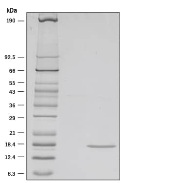 SDS-Page IL-36 gamma/IL-1F9 [Unconjugated]