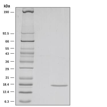 1 µg/lane of Recombinant Human IL-36 gamma /IL-1F9 (aa 18-169) was resolved with SDS-PAGE under reducing (R) conditions and visualized by silver staining, showing a single band at 17 kDa.