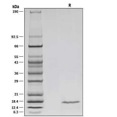 1 µg/lane of Recombinant Mouse IL-36 gamma /IL-1F9 (aa 13-164) was resolved with SDS-PAGE under reducing (R) conditions and visualized by silver staining, showing a single band at 17 kDa.