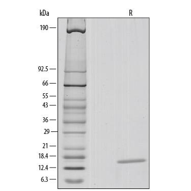 1 μg/lane of Recombinant Human IL-3 was resolved with SDS-PAGE under reducing (R) conditions and visualized by silver staining, showing a single band at 14 kDa.