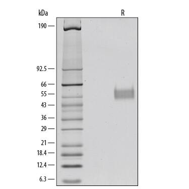 1 μg/lane of Recombinant Human IL-3 R alpha / CD123 was resolved with SDS-PAGE under reducing (R) conditions and visualized by silver staining, showing bands at 55 kDa and 58 kDa.