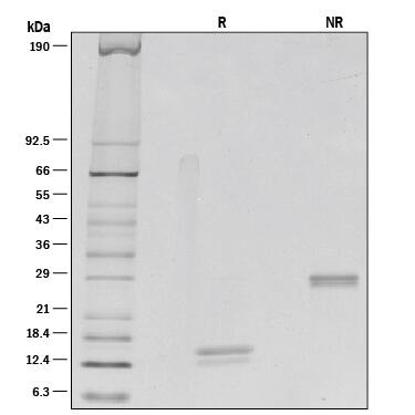 1 μg/lane of Recombinant Human IL-5 was resolved with SDS-PAGE under reducing (R) and non-reducing (NR) conditions and visualized by silver staining, showing bands at 13-15 kDa and 28-32 kDa, respectively.