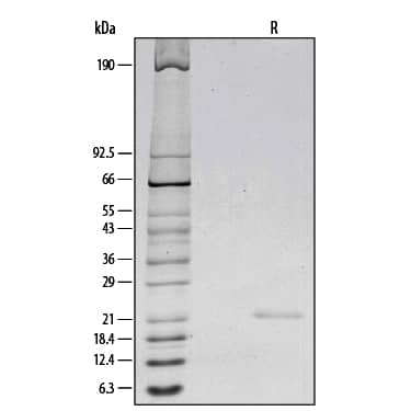 1 μg/lane of Recombinant Human IL-6 was resolved with SDS-PAGE under reducing (R) conditions and visualized by silver staining, showing a single band at 21 kDa.
