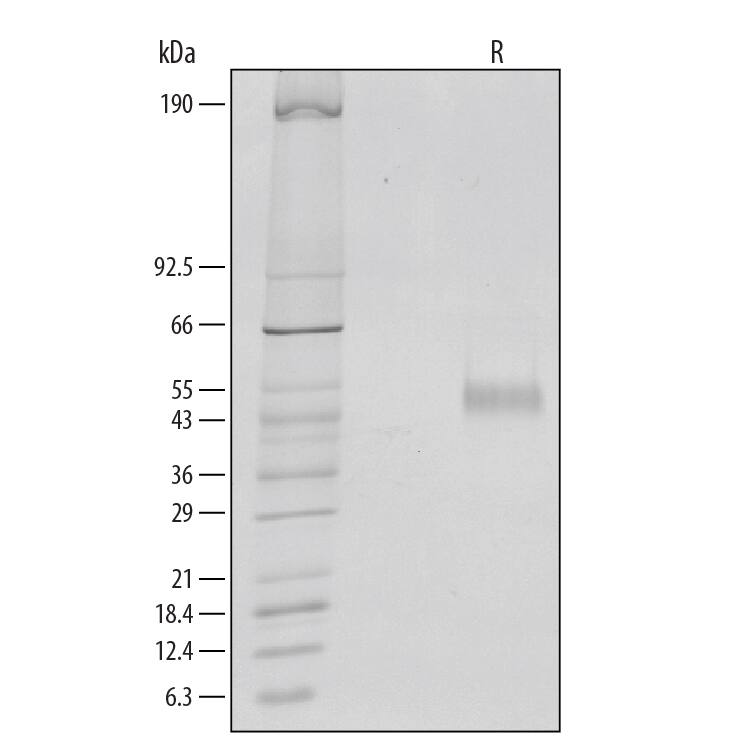 1 μg/lane of Recombinant Human IL6R alpha was resolved with SDS-PAGE under reducing (R) conditions and visualized by silver staining, showing a single band at 45-50 kDa.