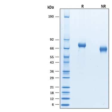 2 μg/lane of Recombinant Cynomolgus Monkey IL-12 (10215-CL) was resolved with SDS-PAGE under reducing (R) and non-reducing (NR) conditions and visualized by Coomassie® Blue staining, showing bands at 65-78 kDa.