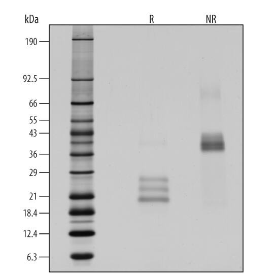 1 μg/lane of Recombinant Human IL-17E (Catalog # 8134-IL) was resolved with SDS-PAGE under reducing (R) and non-reducing (NR) conditions and visualized by silver staining, showing R bands at 20-28 kDa and NR bands at 37-43 kDa.