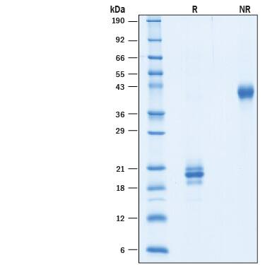 2 μg/lane of Recombinant Cynomolgus/Rhesus Macaque IL-17F His-tag (Catalog # 10225-IL) was resolved with SDS-PAGE under reducing (R) and non-reducing (NR) conditions and visualized by Coomassie® Blue staining, showing bands at 17-25 kDa and 30-50 kDa, respectively.