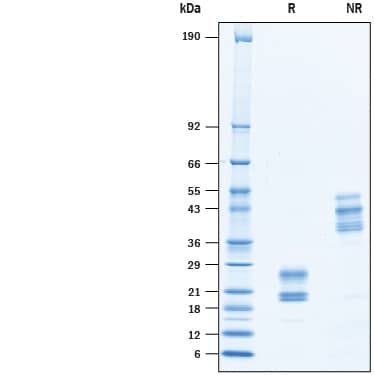 2 μg/lane of Recombinant Mouse IL-17F (Mammalian-expressed) Protein (Catalog # 10424-IL) was resolved with SDS-PAGE under reducing (R) and non-reducing (NR) conditions and visualized by Coomassie® Blue staining, showing bands at 17-27 kDa and 34-54 kDa, repsectively.