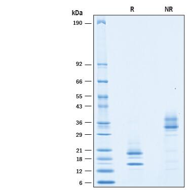 2 μg/lane of Recombinant Cynomolgus Monkey IL-1/IL-17A (Catalog # 10164-IL) was resolved with SDS-PAGE under reducing (R) and non-reducing (NR) conditions and visualized by Coomassie® blue staining, showing bands at 15-25 kDa and 30-50 kDa, respectively.
