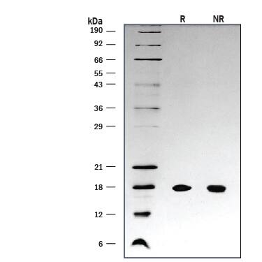 1 μg/lane of Recombinant Human IL-18/IL-1F4 (Catalog # 9124-IL) was resolved with SDS-PAGE under reducing (R) and non-reducing (NR) conditions and visualized by silver staining, showing a single band at 18 kDa.