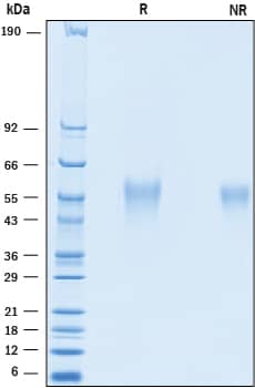 SDS-Page IL-18 BPa/IL18BP [Unconjugated]
