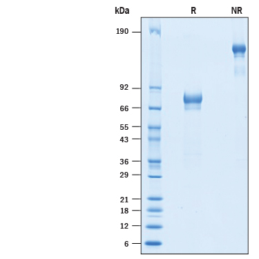 2 μg/lane of Recombinant Cynomolgus Monkey/Rhesus Macaque IL-21R Fc Chimera Protein (Catalog # 10482-R2) was resolved with SDS-PAGE under reducing (R) and non-reducing (NR) conditions and visualized by Coomassie® Blue staining, showing bands at 60-80 kDa and 110-160 kDa, respectively.