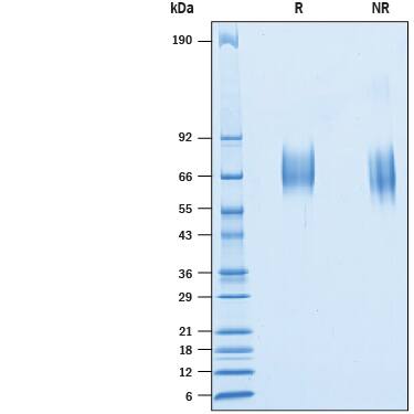 2 μg/lane of Recombinant Cynomolgus Monkey IL-23R His-tag (Catalog # 10331-IR) was resolved with SDS-PAGE under reducing (R) and non-reducing (NR) conditions and visualized by Coomassie® Blue staining, showing bands at 63-70 kDa.