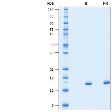 2 μg/lane of Recombinant Human IL-2 (Mammalian-expressed) Protein (10453-IL) was resolved with SDS-PAGE under reducing (R) and non-reducing (NR) conditions and visualized by Coomassie® Blue staining, showing bands at 14-18 kDa.