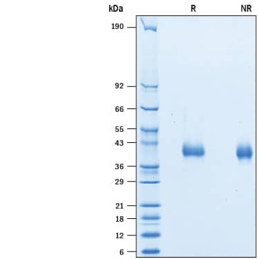SDS-Page IL-2 R beta [Biotin]