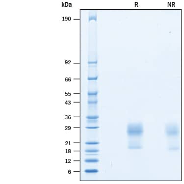 2 μg/lane of Recombinant Human IL-31 (HEK293-expressed) Protein (Catalog # 10425-IL) was resolved with SDS-PAGE under reducing (R) and non-reducing (NR) conditions and visualized by Coomassie® Blue staining, showing bands at 19-29 kDa.
