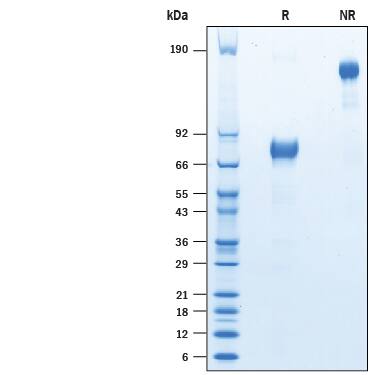 SDS-Page IL-4R alpha [Biotin]