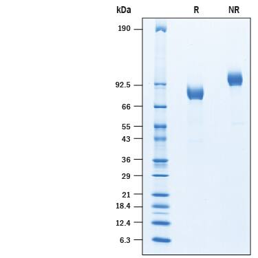 2 μg/lane of Recombinant Human ITIH1 His-tag was resolved with SDS-PAGE under reducing (R) and non-reducing (NR) conditions and visualized by Coomassie® Blue staining, showing a band at 80 kDa under reducing conditions.