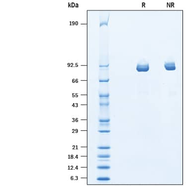 2 μg/lane of Recombinant Human ITIH3 His-tag Protein (Catalog # 10427-IT) was resolved with SDS-PAGE under reducing (R) and non-reducing (NR) conditions and visualized by Coomassie® Blue staining, showing bands at approximately 86 and 93 kDa under reducing conditions.