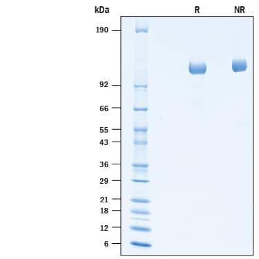 2 μg/lane of Recombinant Human ITIH4 His-tag was resolved with SDS-PAGE under reducing (R) and non-reducing (NR) conditions and visualized by Coomassie® Blue staining, showing a band at 115 kDa under reducing conditions.
