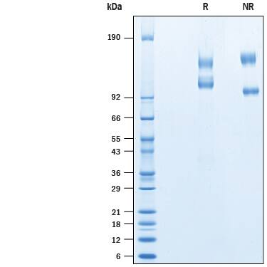 SDS-Page Integrin alpha V beta 3 [Unconjugated]