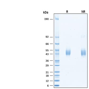 SDS-Page KIR3DL3/CD158z [Unconjugated]